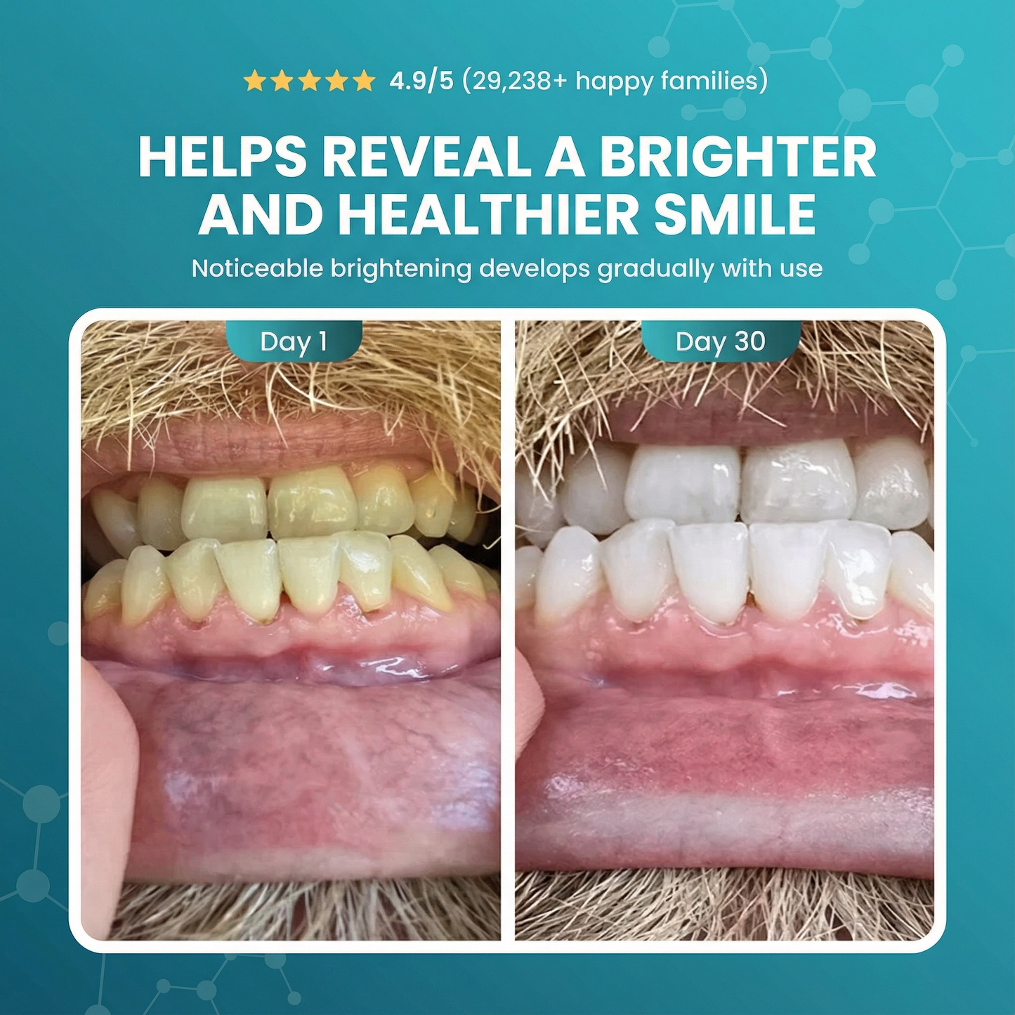 Dentì Nano-Hydroxyapatite Toothpaste Tablets